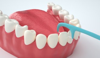 Does dental floss make the gaps between teeth bigger ? 